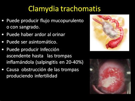 Salud Para La Mujer Y El Hombre Infecciones Vaginales Que Son Y Como