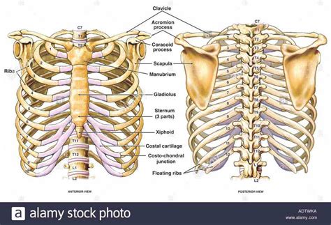 Rib fractures most commonly occur in the middle ribs, as a consequence of crushing injuries or direct trauma. Anatomy Of The Ribs And Sternum | MedicineBTG.com