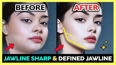 Perfect Jawline Chiseled Jawline Lean Legs Cosmetic Treatments