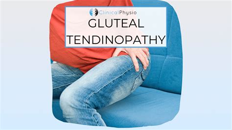 Gluteal Tendinopathy Clinical Physio Membership
