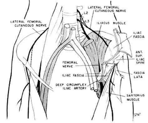 Drawing Of The Course Of The Lateral Femoral Cutaneous Nerve Lfcn And