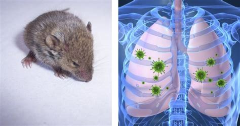 What Is Hantavirus Outbreak History Symptoms And Causes