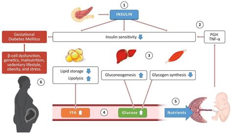 Gestational Diabetes Diagram