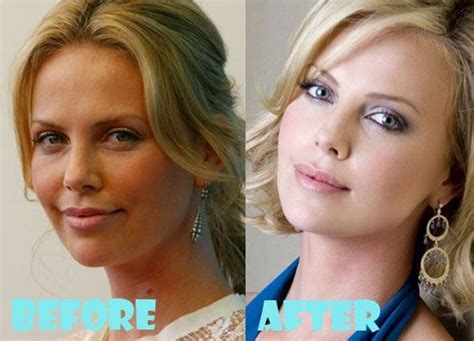 Charlize Theron Plastic Surgery Before And After Pictures Lovely Surgery Plastic Surgery