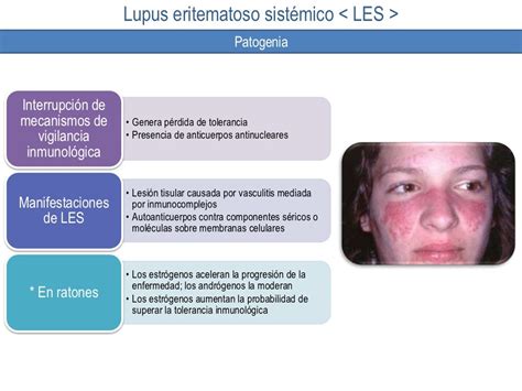 Lupus Eritematoso Sistémico