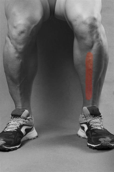 Most common running injury - The Shin Splints | Just Run Lah!