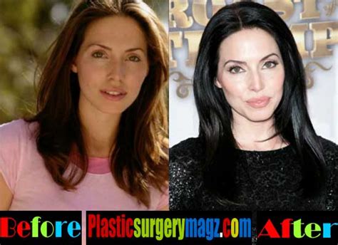 Whitney Cummings Plastic Surgery Before And After Pictures Plastic