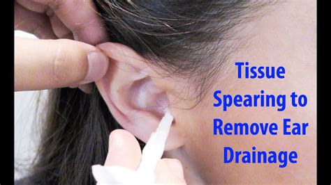 Fluid In Ear Draining