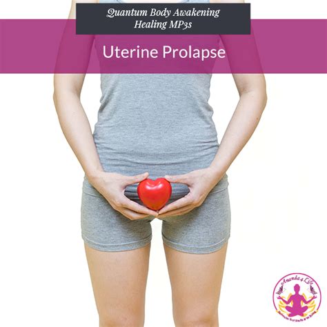 Uterine Prolapse Pictures