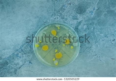 Yellow Bacterial Colonies On Nutrient Agar Stock Photo 1320505229