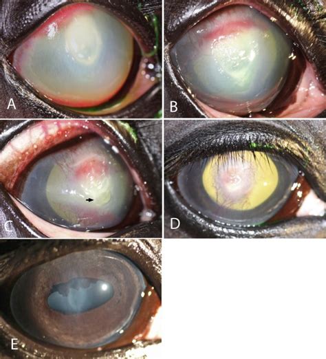 Natural Treatment For Corneal Scarring Hagenhoff Valerie