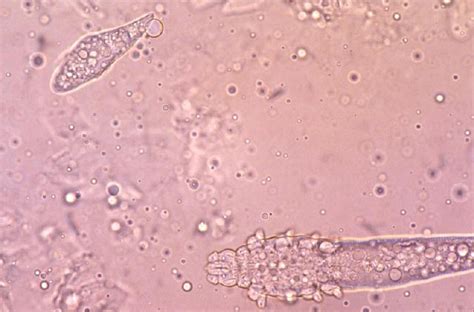 Demodectic Mange Demodicosis Parasites Parasitic Skin Conditions
