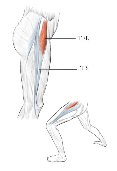 How To Get Rid Of Pain In The Tfl Tensor Fascia Lata