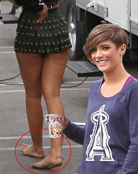 Ouch Those Blisters Look Nasty Frankie Sandford Ok Magazine