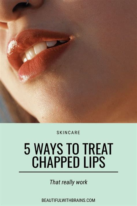 Ways To Treat Chapped Lips That Really Work Click This Pin To Find