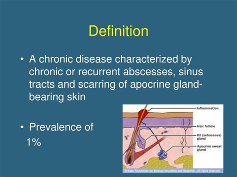 Ppt Hidradenitis Suppurativa Powerpoint Presentation Free Download