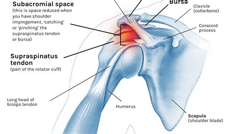 Got Shoulder Impingement Do These 2 Exercises Tom Morrison