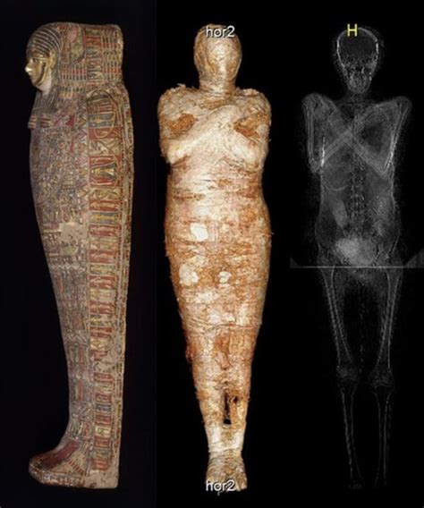 Esta é a primeira múmia já encontrada de uma grávida - Gizmodo Brasil