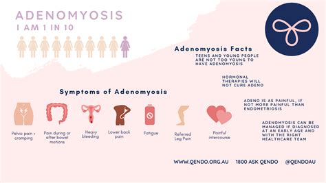Introducing Adenomyosis Qendo
