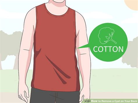 4 Ways To Remove A Cyst On Your Back Wikihow