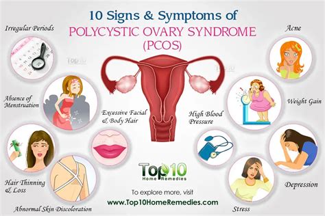 What Is Pcos Causes Symptoms Treatment