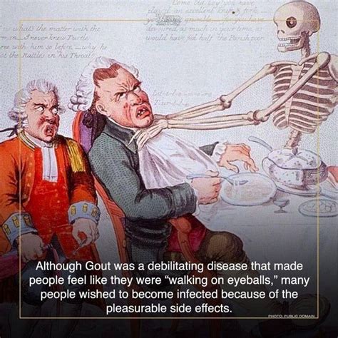 All About Gout, 'The Disease Of Kings' | Gout, Disease, Gout flare up