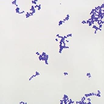 And pneumococcal infections, such as bacterial pneumonia. Amazon.com: Gram-Positive Coccus Slide, w.m, Gram Stain ...