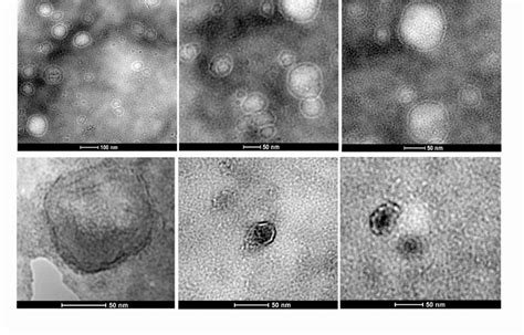 Characterization Of Exosomes Isolated From Bone Marrow Derived Msc