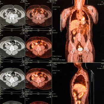 Pet wellness life stress scan. How is PET-CT different from traditional PET imaging ...