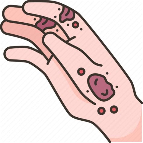 Dermatitis Skin Rash Allergy Infection Icon Download On Iconfinder