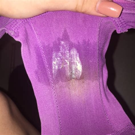 Ive Never Seen My Underwear This Wet Before And Idk If My Discharge Looks Normal Does It Look