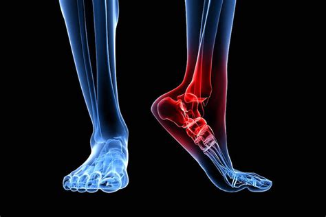 Foot And Ankle Trauma Orthopaedic Au