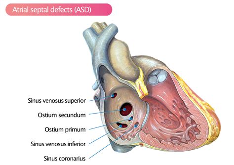 Congenital Heart Disease And Guch Grown Up Congenital Heart Disease