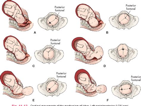 Birth Positions In Labour