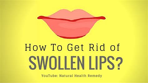 How To Get Rid Of Swollen Lips From Allergy At Home Youtube