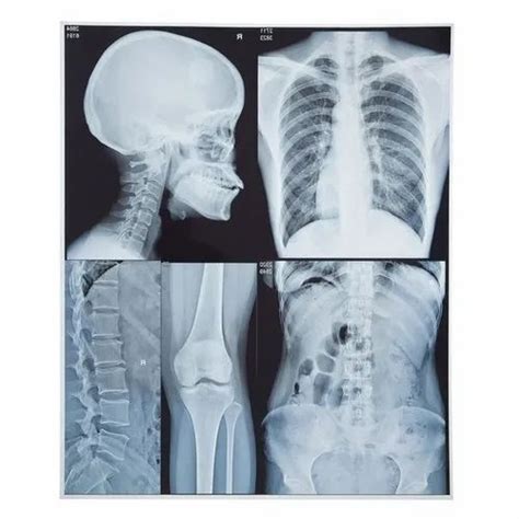 X Ray Films Radiographic Films Latest Price Manufacturers And Suppliers