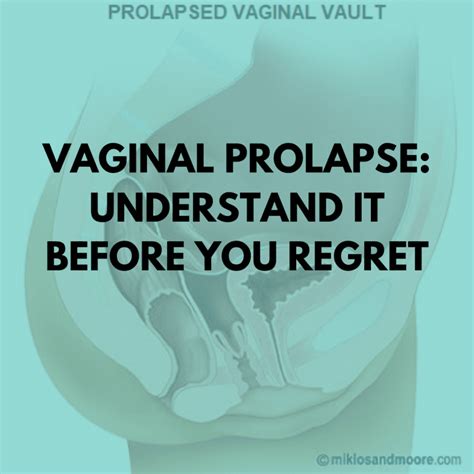 Vaginal Prolapse Understand It Before You Regret
