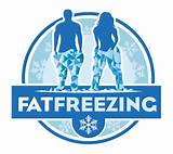 Photos of Fat Freezing Treatment Prices
