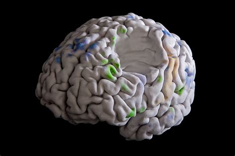 3d Printing Of Fantastic Human Brain Scans Cuh Media