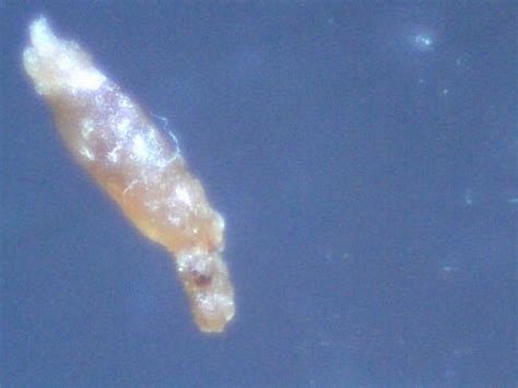 Baby worms or larval helminthes? Morgellons Worm | Flickr - Photo Sharing!