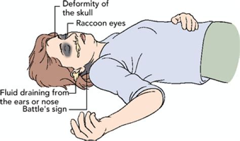 Head And Neck Musculoskeletal Key