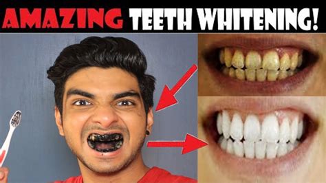 Teeth Whitening At Home With Charcoal Powder How To Whiten Your Yellow Teeth Naturally Hindi