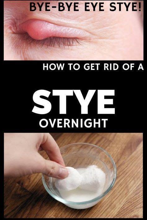 How To Get Rid Of A Stye Overnight Eye Stye Remedies Stye Stye Remedy