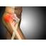 Hip Pain Keeps Coming Back  Evolve Restorative Therapy