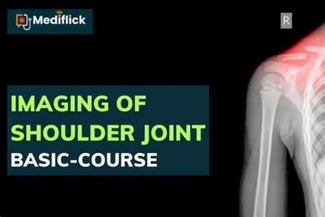 Shoulder Joint Imaging Lectures And Refresher Courses 2022 Shoulder