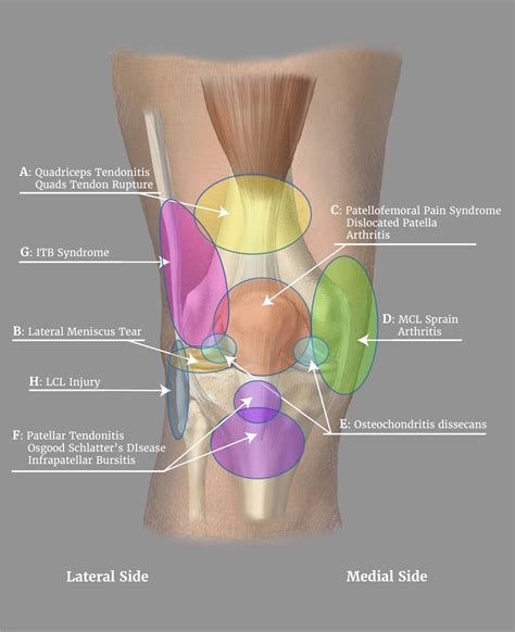 Knee Pain Symptom Checker Online Knee Injury Self Diagnosis Tool
