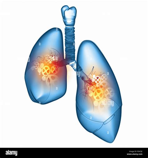 Lungs Hi Res Stock Photography And Images Alamy