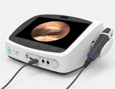 Video Usb Otoscope Digital Camera For Ear Inspection Visionflex