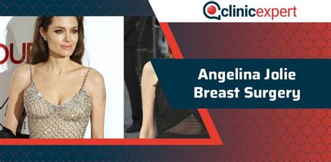 Angelina Jolie Breast Surgery Clinicexpert International Healthcare