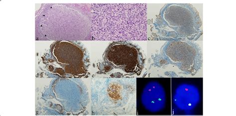 A representative case of a low-grade primary intestinal ...